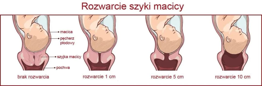 Rozwarcie na 2 palce: ile cm to jest i co oznacza w porodzie?